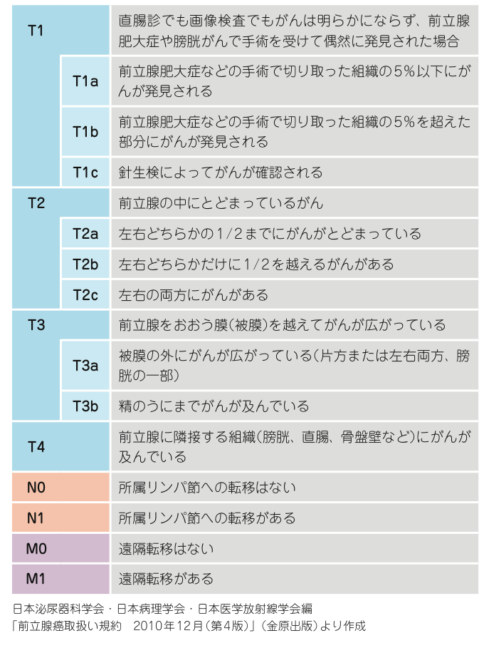 検査 前立腺 癌 前立腺がん