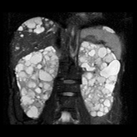 核磁気共鳴装置（MRI）