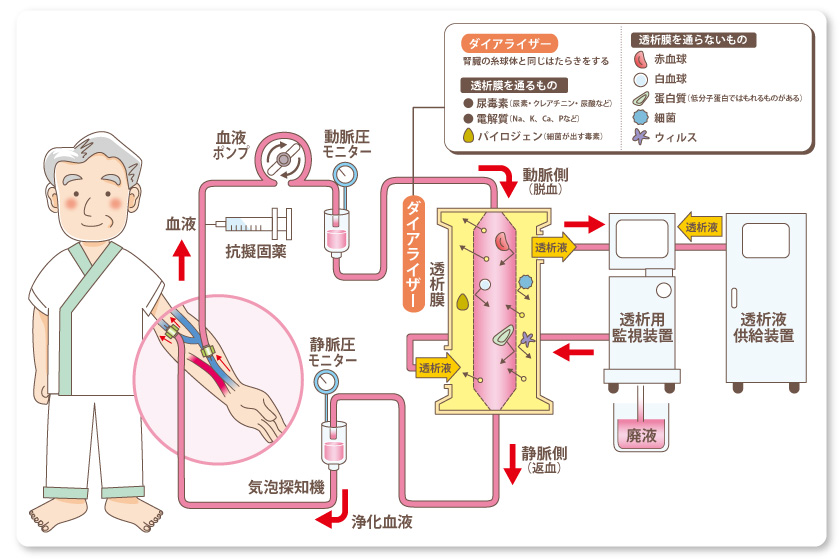 と は 透析 血液