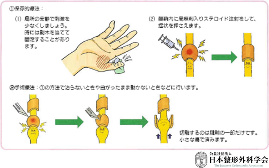 とくなが法