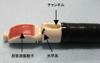 超音波気管支鏡ガイド下針生検（EBUS-TBNA）