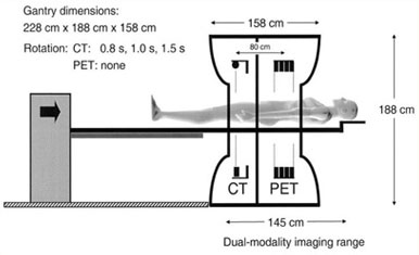 FDG-PET