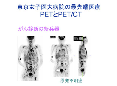 qa@̍Ő[PETPET/CT