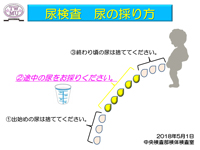 中間尿採取のお願い