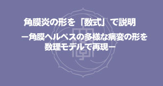 【プレスリリース】眼科学